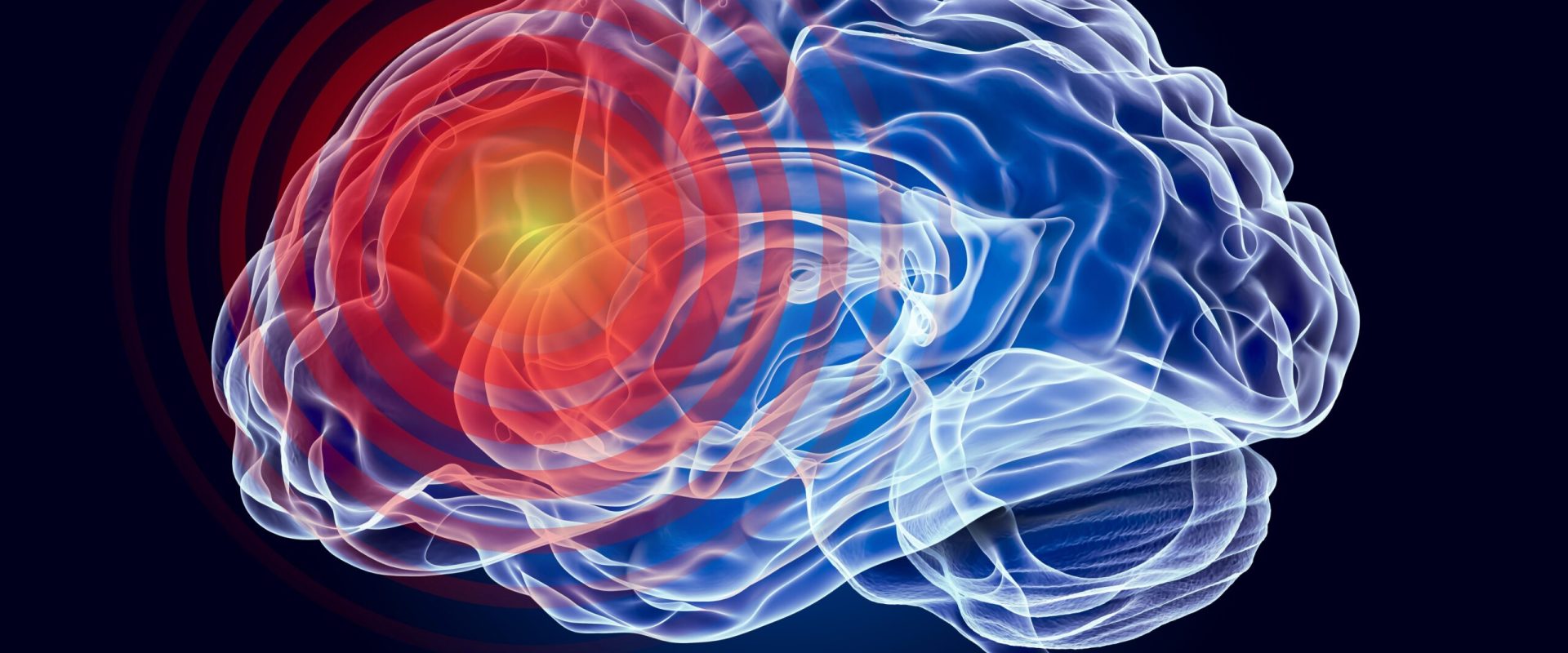 O boală neurologică, necunoscută, face ravagii: Ce se întâmplă în lume