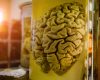 Creier de 10.000 ani intact, corp dispărut. Misterul conservării