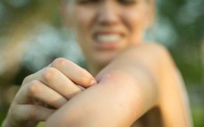 Malaria ucigașă pe aeroport german: Țânțari aduși de un avion