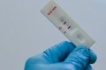 Rusia: HIV în scădere? Experții nu sunt convinși