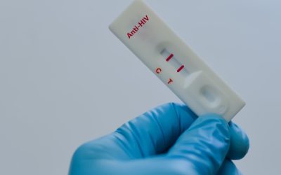 Rusia: HIV în scădere? Experții nu sunt convinși