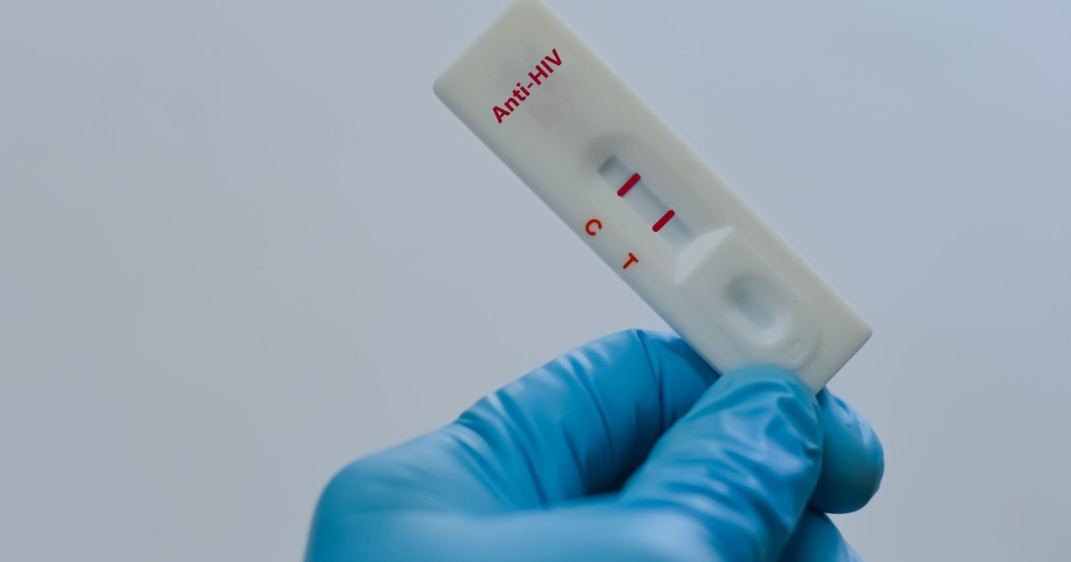 Rusia: HIV în scădere? Experții nu sunt convinși