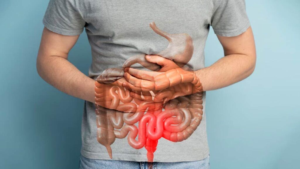 Cancer colon stadiul IV după 10 ani de ignorat simptom banal