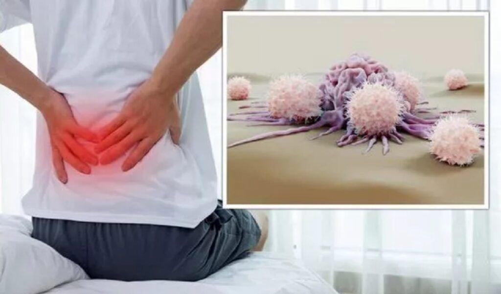 Cancerul „mut”: 5 simptome ascunse de o durere banală