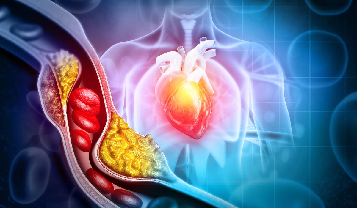 Infarct cu colesterol normal? Medici, alertă risc nevăzut