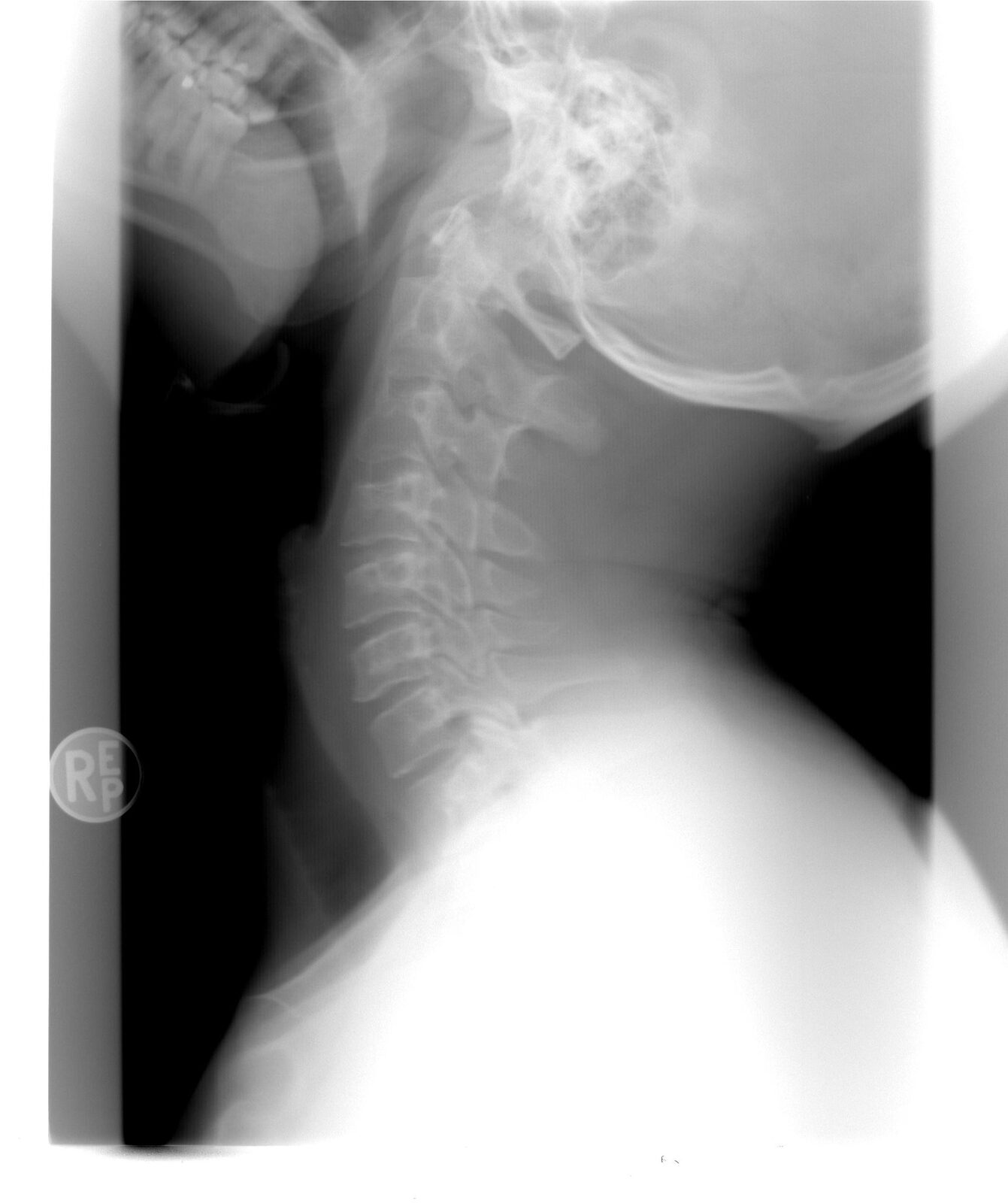 Spitalul Bihor: AI ajută radiologii să citească urgente medicale