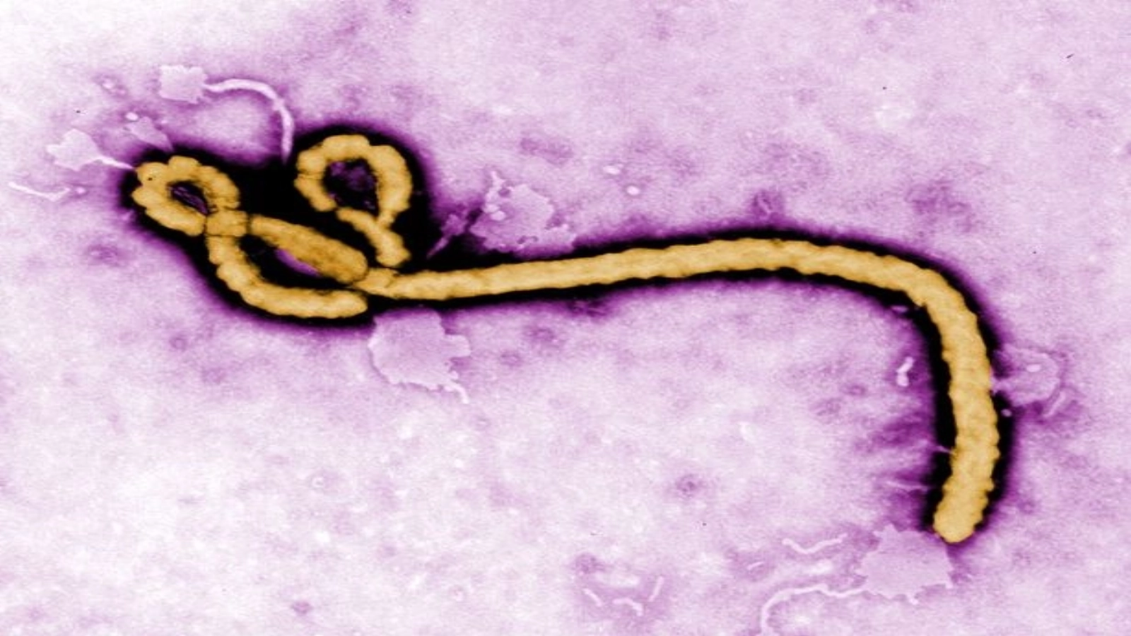 Ebola: O amenințare globală, cea mai cumplită epidemie