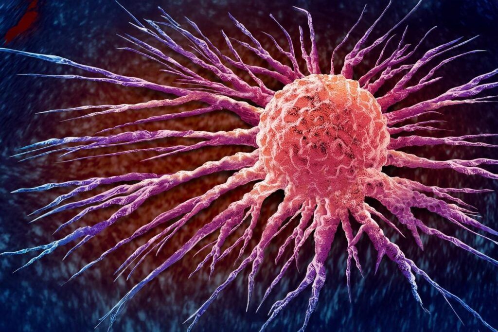 Cancer: Vaccin pe măsura tumorii tale