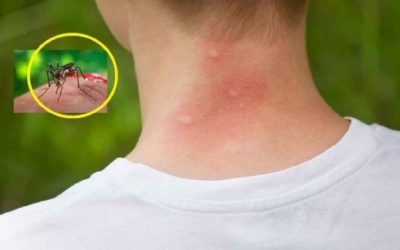 Țânțarii te aleg pe tine? Trei bacterii atacă secretul lor