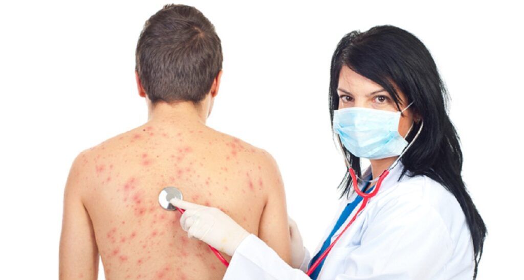 Zoster: Vaccinul care protejează creierul de demență
