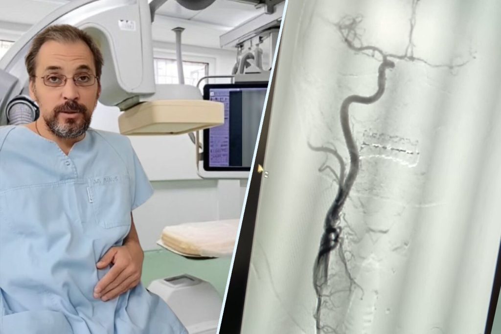 Dr. Pănuș face istorie la SJU Buzău: Premieră medicală