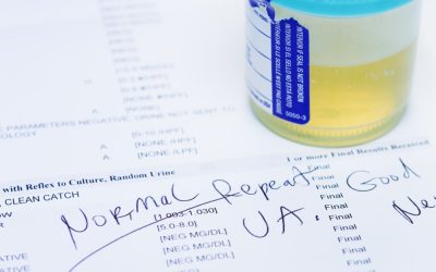 Test de urină, 9 din 10 cancere de vezică depistate